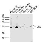 CD9 Antibody in Western Blot (WB)
