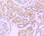 BCL2 Antibody in Immunohistochemistry (Paraffin) (IHC (P))