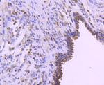 BCL2 Antibody in Immunohistochemistry (Paraffin) (IHC (P))