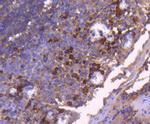 Bax Antibody in Immunohistochemistry (Paraffin) (IHC (P))