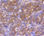 Bax Antibody in Immunohistochemistry (Paraffin) (IHC (P))