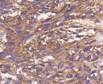Bax Antibody in Immunohistochemistry (Paraffin) (IHC (P))