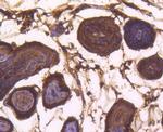 Bax Antibody in Immunohistochemistry (Paraffin) (IHC (P))