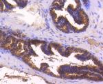 Bax Antibody in Immunohistochemistry (Paraffin) (IHC (P))