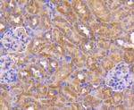 Bax Antibody in Immunohistochemistry (Paraffin) (IHC (P))