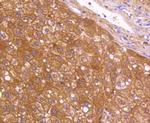 Neuropilin-1 Antibody in Immunohistochemistry (Paraffin) (IHC (P))
