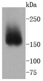 Integrin alpha 2 Antibody in Western Blot (WB)