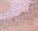 TrkA+B+C Antibody in Immunohistochemistry (Paraffin) (IHC (P))