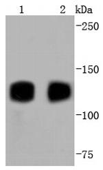 TrkA+B+C Antibody in Western Blot (WB)