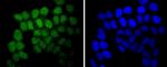 SUZ12 Antibody in Immunocytochemistry (ICC/IF)