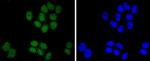 SUZ12 Antibody in Immunocytochemistry (ICC/IF)