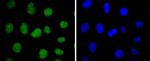 SUZ12 Antibody in Immunocytochemistry (ICC/IF)