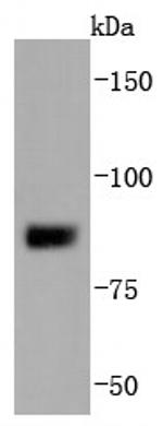 SUZ12 Antibody in Western Blot (WB)