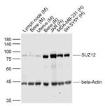 SUZ12 Antibody in Western Blot (WB)