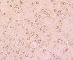 DRD1 Antibody in Immunohistochemistry (Paraffin) (IHC (P))
