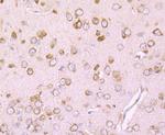 DRD1 Antibody in Immunohistochemistry (Paraffin) (IHC (P))