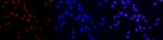 HDAC2 Antibody in Immunocytochemistry (ICC/IF)