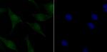 Phospho-ATM (Ser1981) Antibody in Immunocytochemistry (ICC/IF)