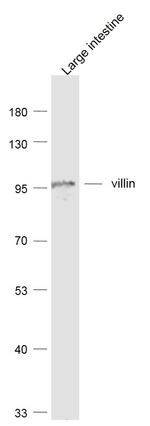 VIL1 Antibody in Western Blot (WB)