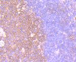 CXCR5 Antibody in Immunohistochemistry (Paraffin) (IHC (P))