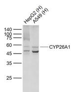 CYP26A1 Antibody in Western Blot (WB)