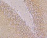 ARHGEF2 Antibody in Immunohistochemistry (Paraffin) (IHC (P))