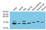 FRATAXIN Antibody in Western Blot (WB)