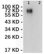 ERBB2 Antibody in Western Blot (WB)