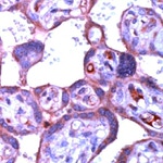 c-Abl Antibody in Immunohistochemistry (IHC)