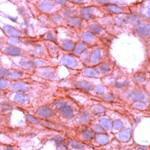 ErbB4 Antibody in Immunohistochemistry (IHC)