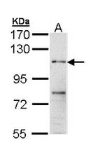 MERTK Antibody in Western Blot (WB)