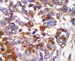 cGKI Antibody in Immunohistochemistry (IHC)