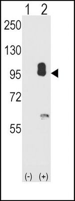 cGKII Antibody in Western Blot (WB)