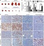 Ki-67 Antibody in Immunohistochemistry (IHC)