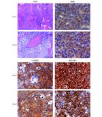 Estrogen Receptor beta Antibody in Immunohistochemistry (Paraffin) (IHC (P))