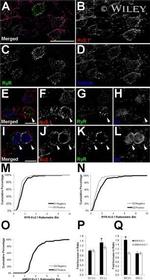 RyR1 Antibody in Immunohistochemistry - Free Floating (IHC (Free))