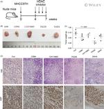 Ki-67 Antibody in Immunohistochemistry (IHC)