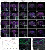 GFP Antibody in Immunohistochemistry (IHC)