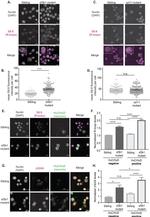 HuC/HuD Antibody in Immunocytochemistry (ICC/IF)