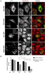 Calreticulin Antibody in Immunocytochemistry (ICC/IF)
