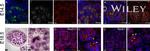 E-cadherin Antibody in Immunohistochemistry (IHC)