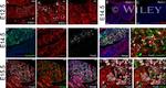 E-cadherin Antibody in Immunohistochemistry (IHC)