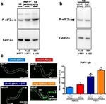 Phospho-EIF2S1 (Ser52) Antibody in Western Blot (WB)