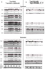 Phospho-Tau (Thr231) Antibody in Western Blot (WB)