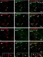 Connexin 43 Antibody in Immunohistochemistry (IHC)