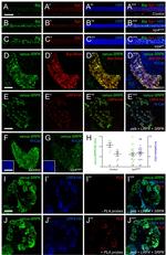 GFP Antibody in Immunocytochemistry (ICC/IF)