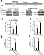 PKD2 Antibody in Western Blot (WB)