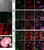 PKD2 Antibody in Immunocytochemistry (ICC/IF)