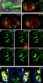 HuC/HuD Antibody in Immunohistochemistry (IHC)