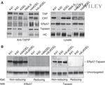 Calreticulin Antibody in Western Blot (WB)